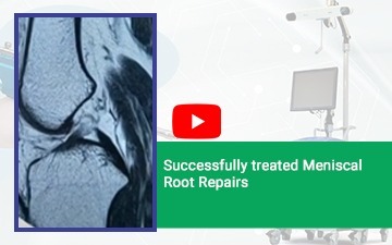 Meniscal root repair